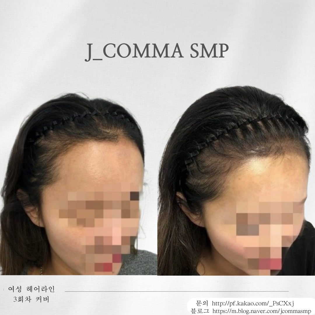 제이콤마