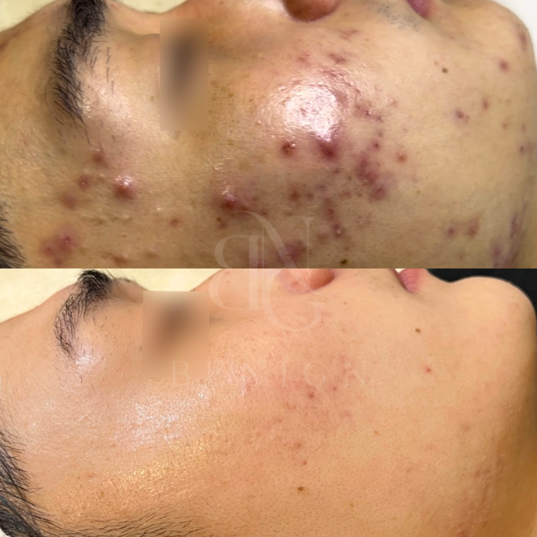 비나인에스테틱 대표 이미지