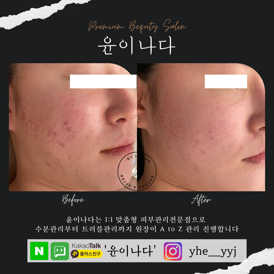 윤이나다