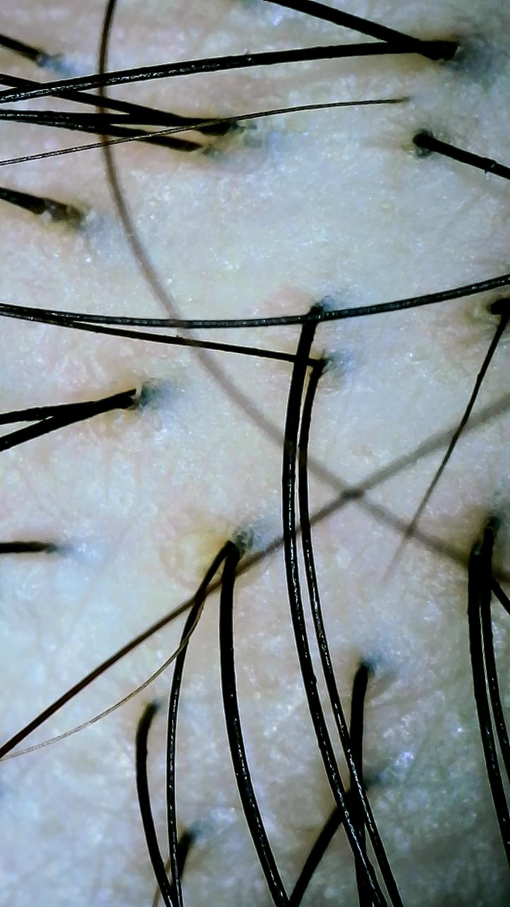 웰스칼프 대표 이미지