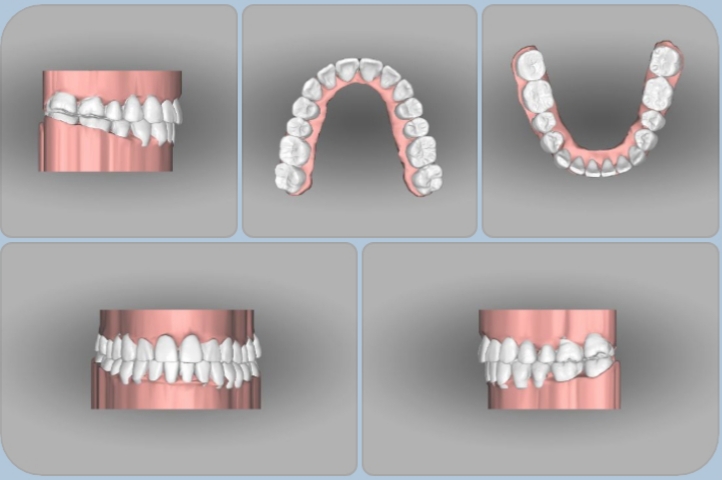 은혜치과의원 대표 이미지