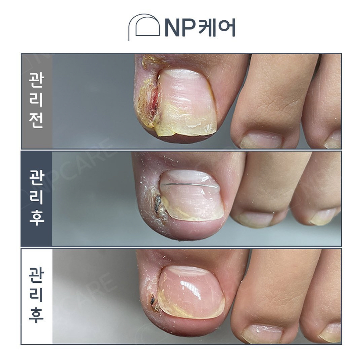 엔피케어 부산연산점