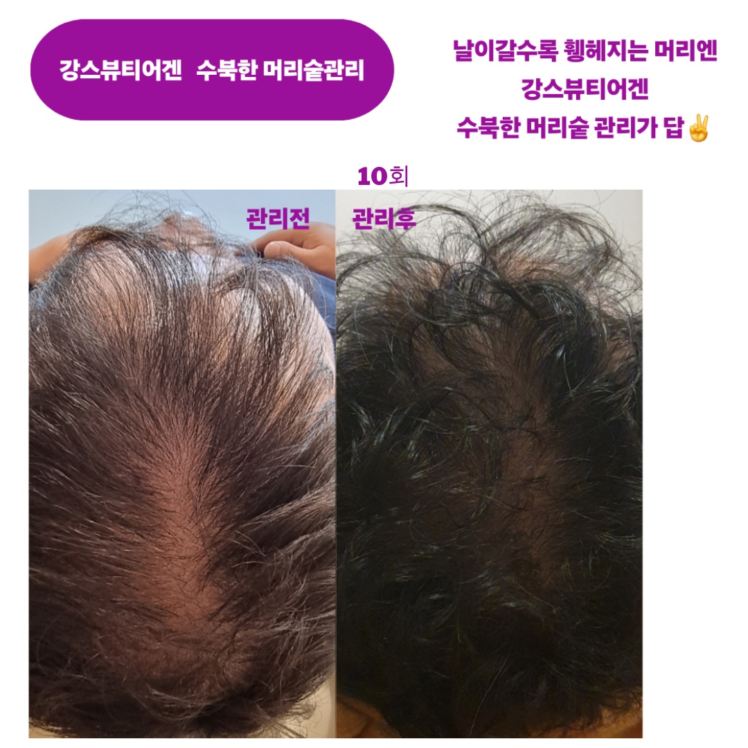 강스뷰티어겐 photo 10