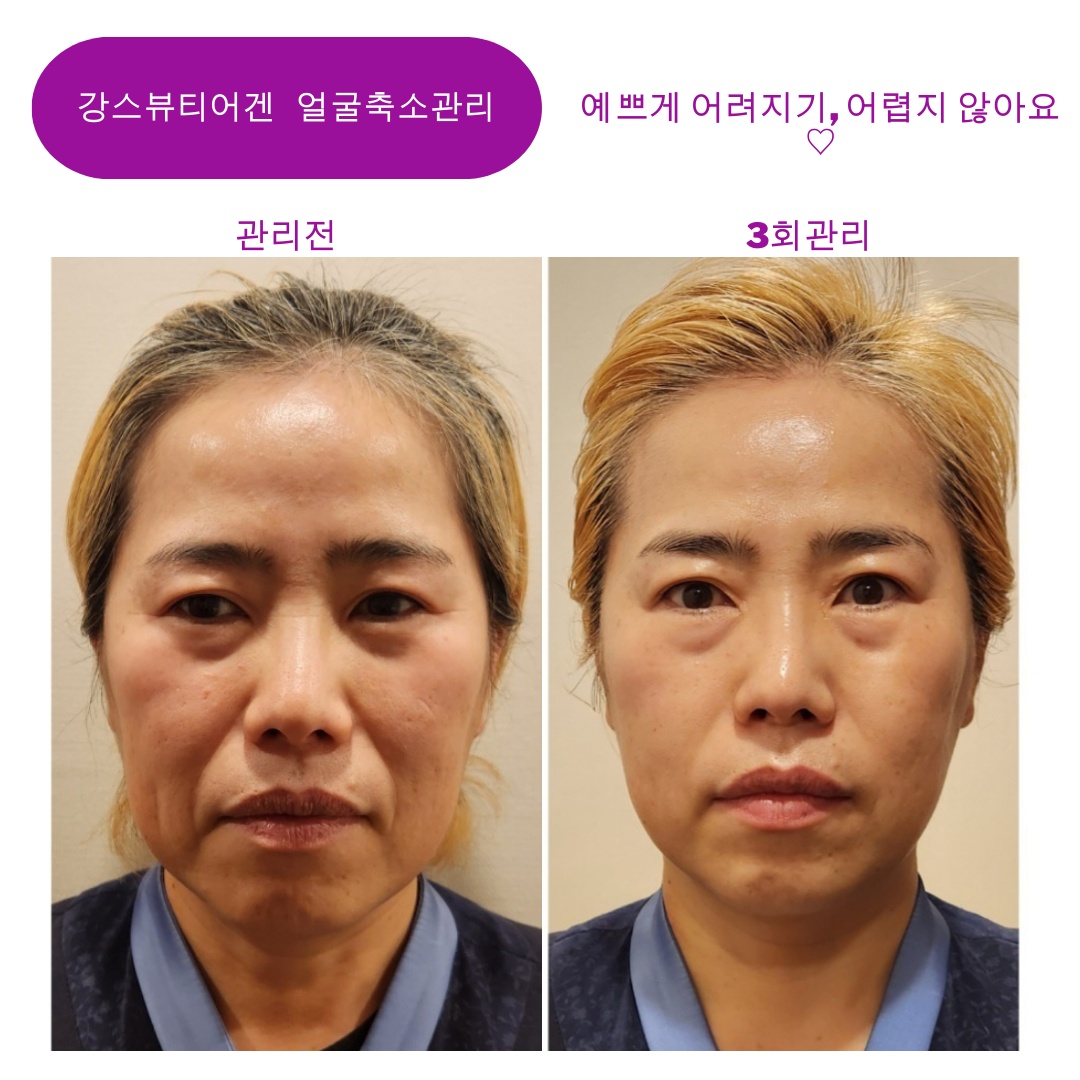 강스뷰티어겐 photo 3