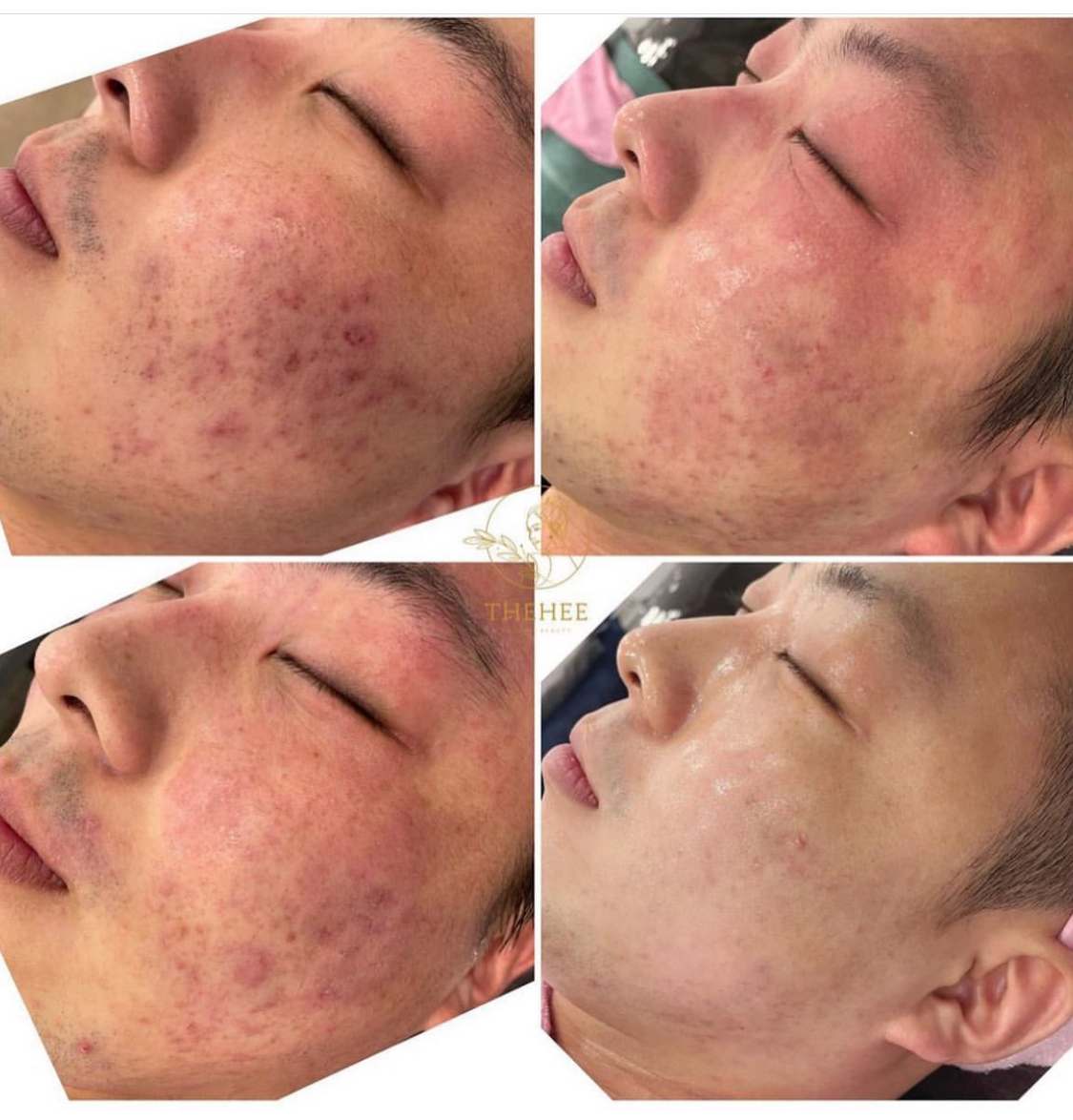 유앤희에스테틱 광주첨단점