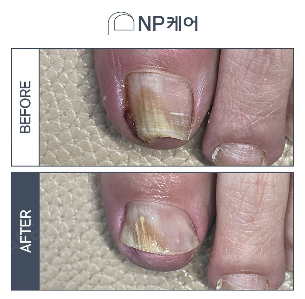 엔피케어 부산연산점