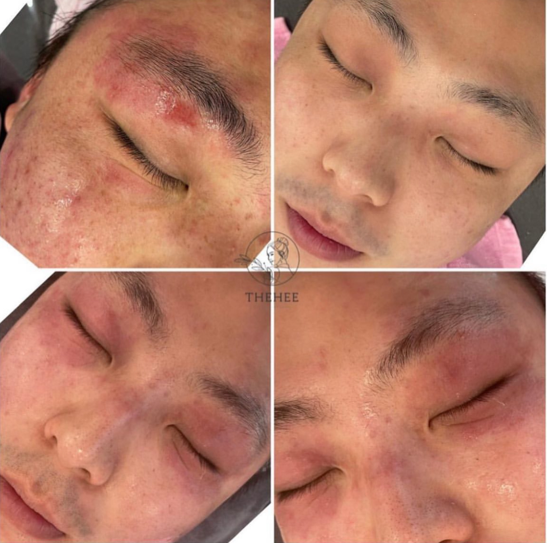 유앤희에스테틱 광주첨단점