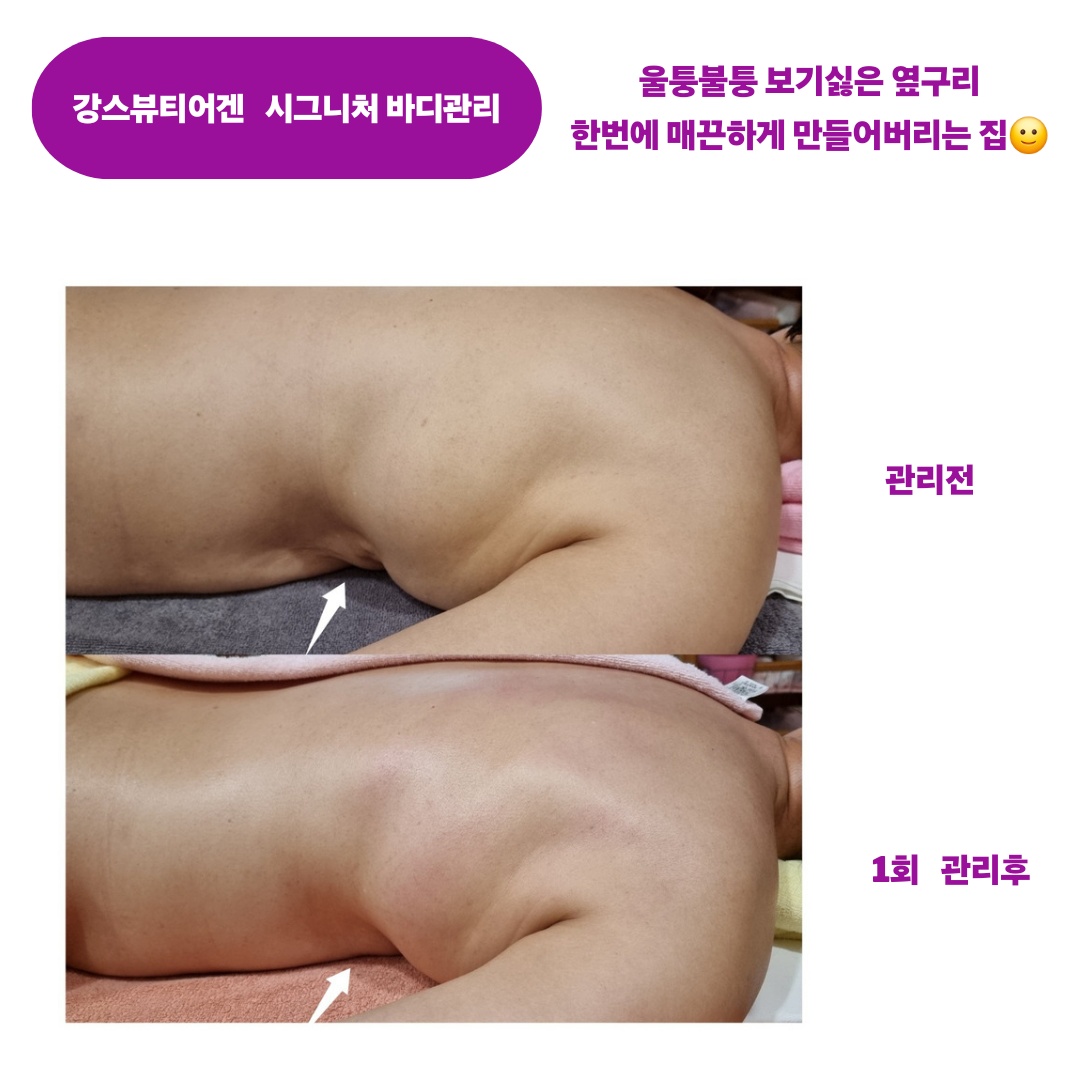 강스뷰티어겐 photo 9