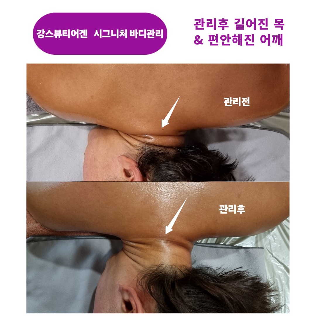 강스뷰티어겐 photo 5