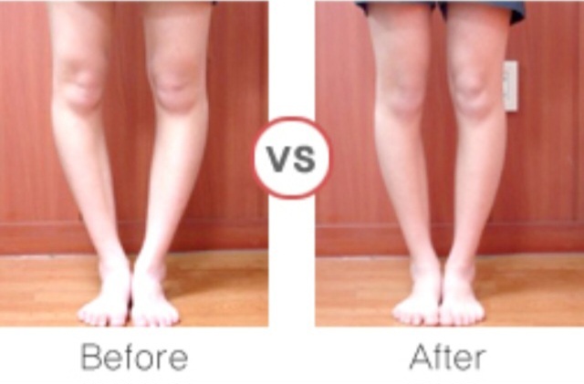 손인수의 체형 필라테스 대표 이미지