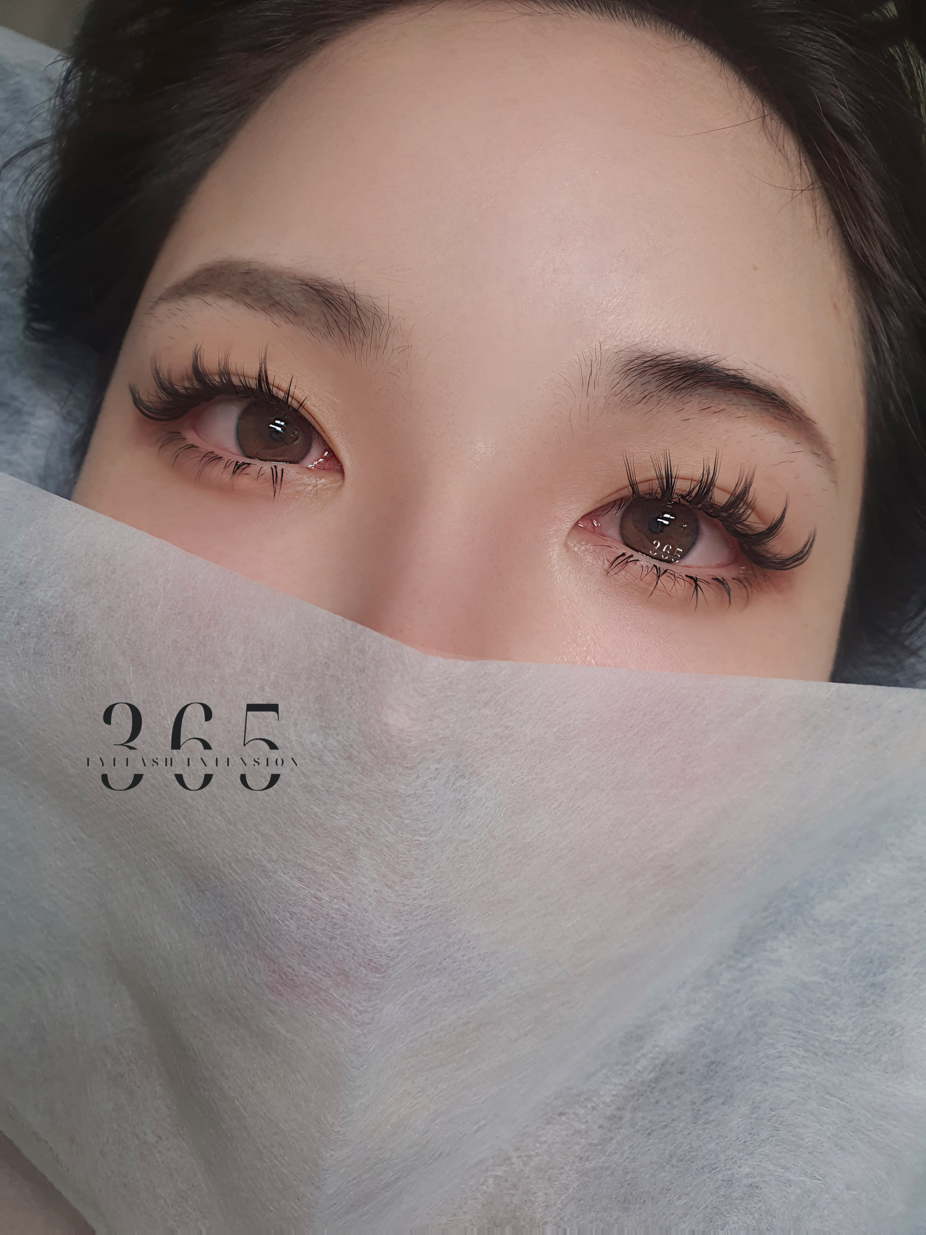 바디톡스