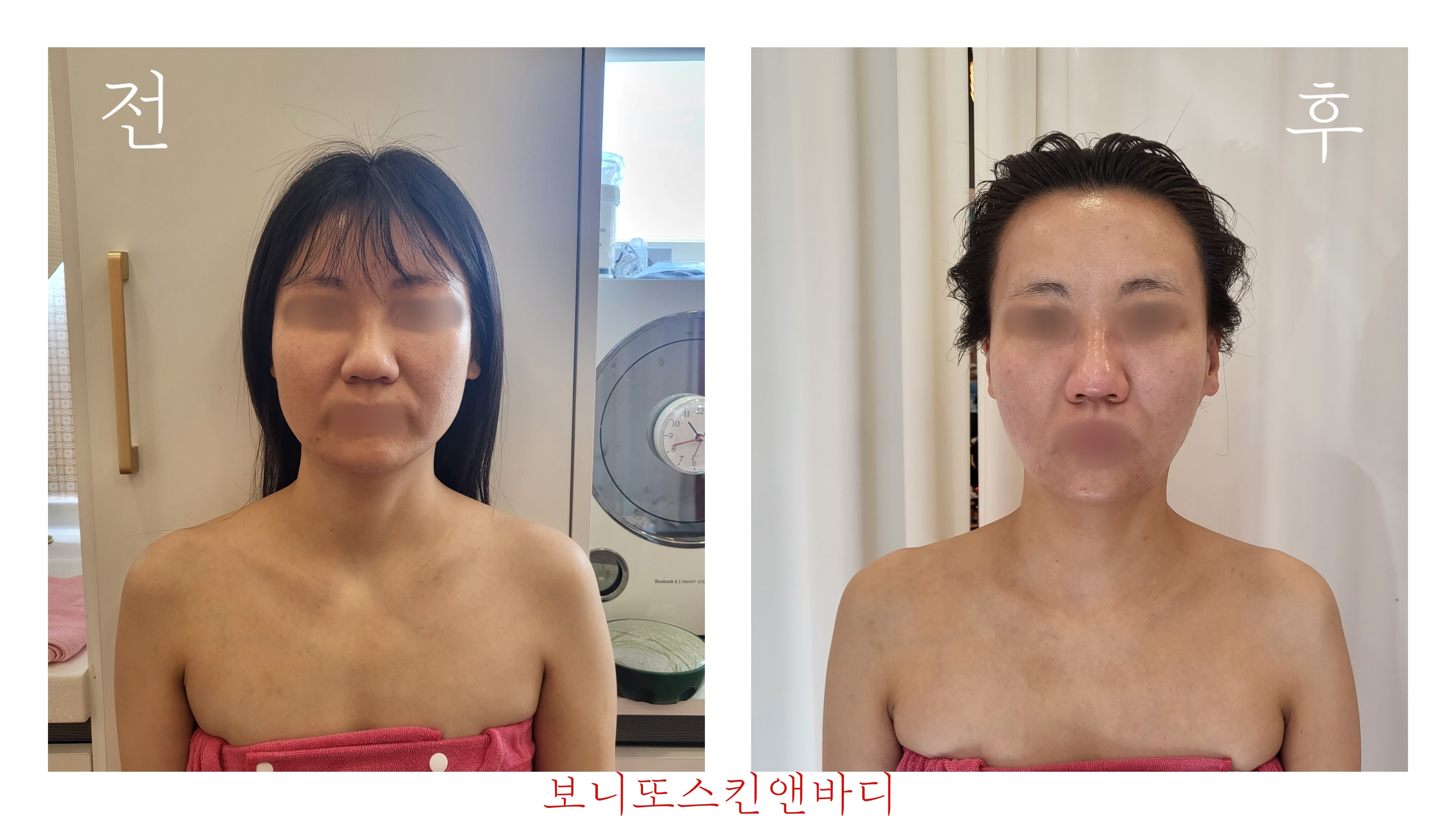 보니또 스킨앤바디