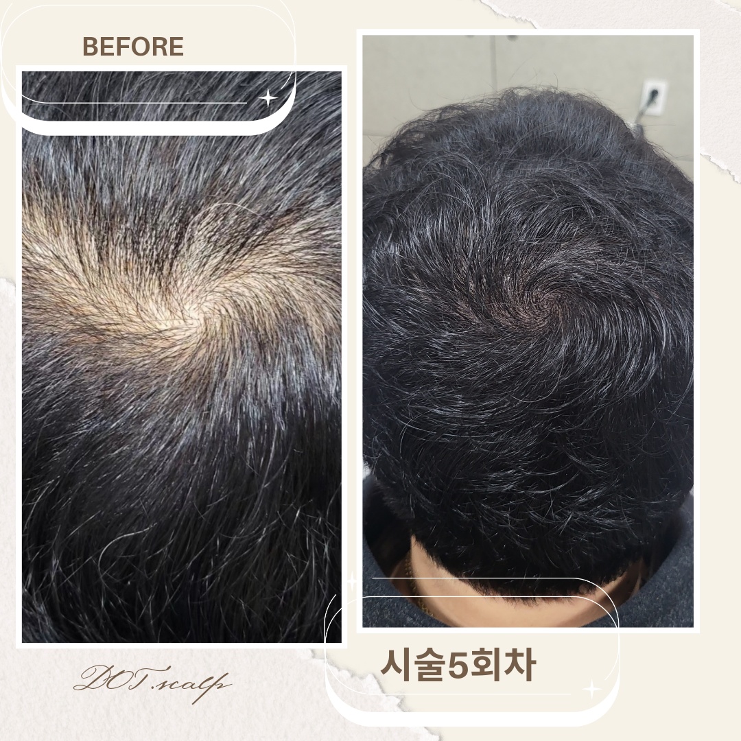 도트스칼프 대표 이미지