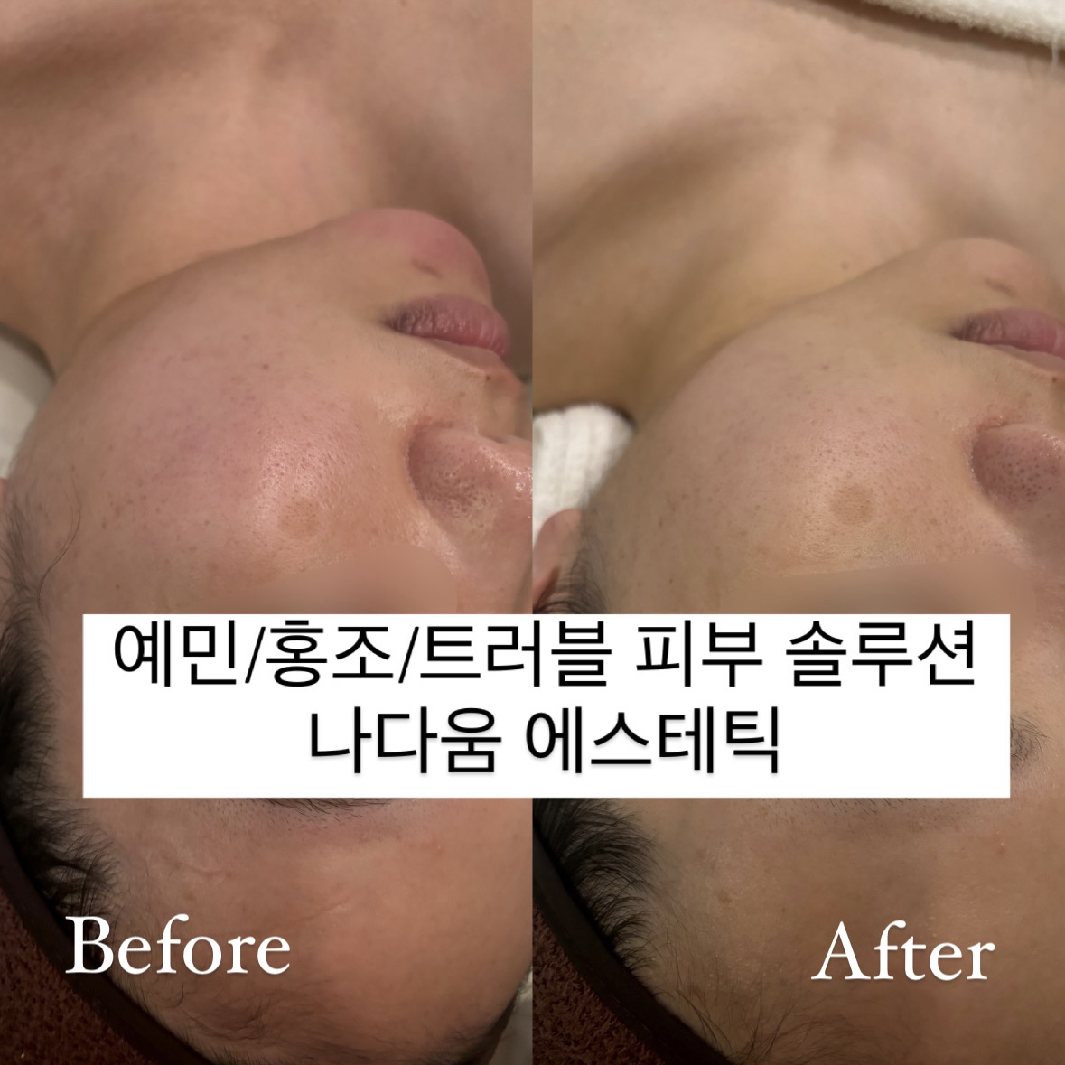 나다움 에스테틱