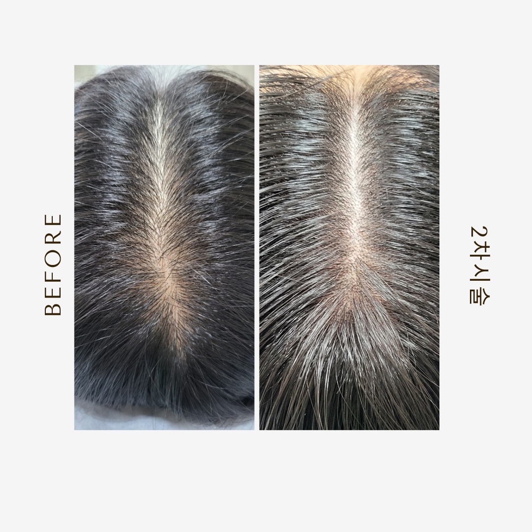 도트스칼프 대표 이미지