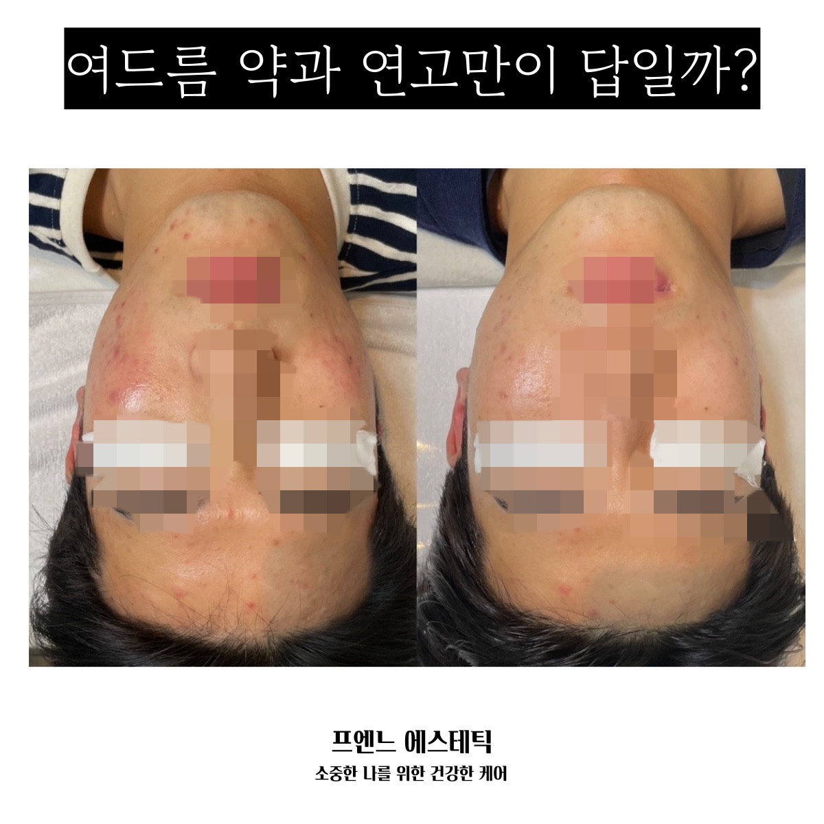 라온제이 에스테틱