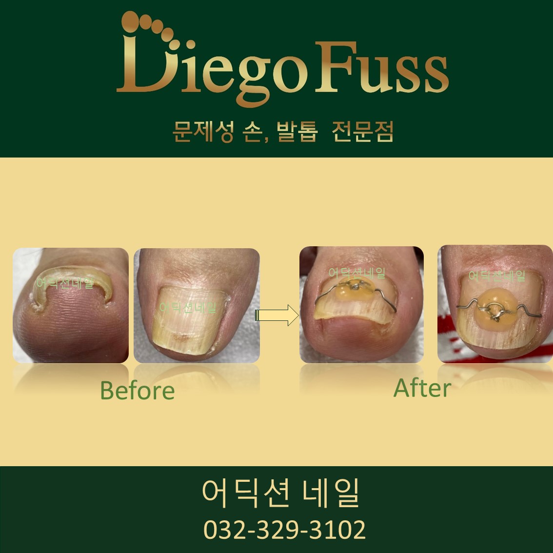부천디에고푸스본점어딕션네일&풋케어전문