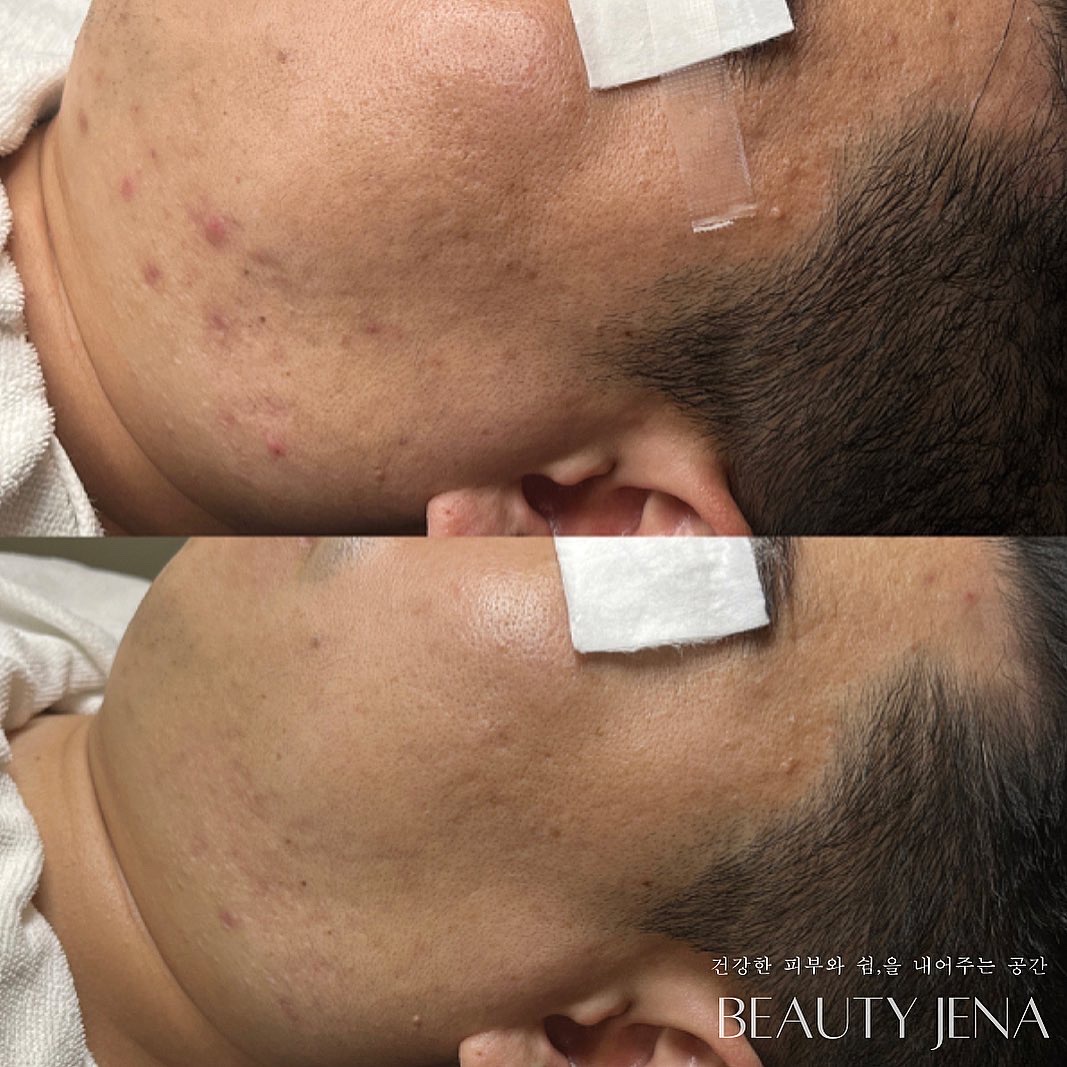 뷰티제나 대표 이미지