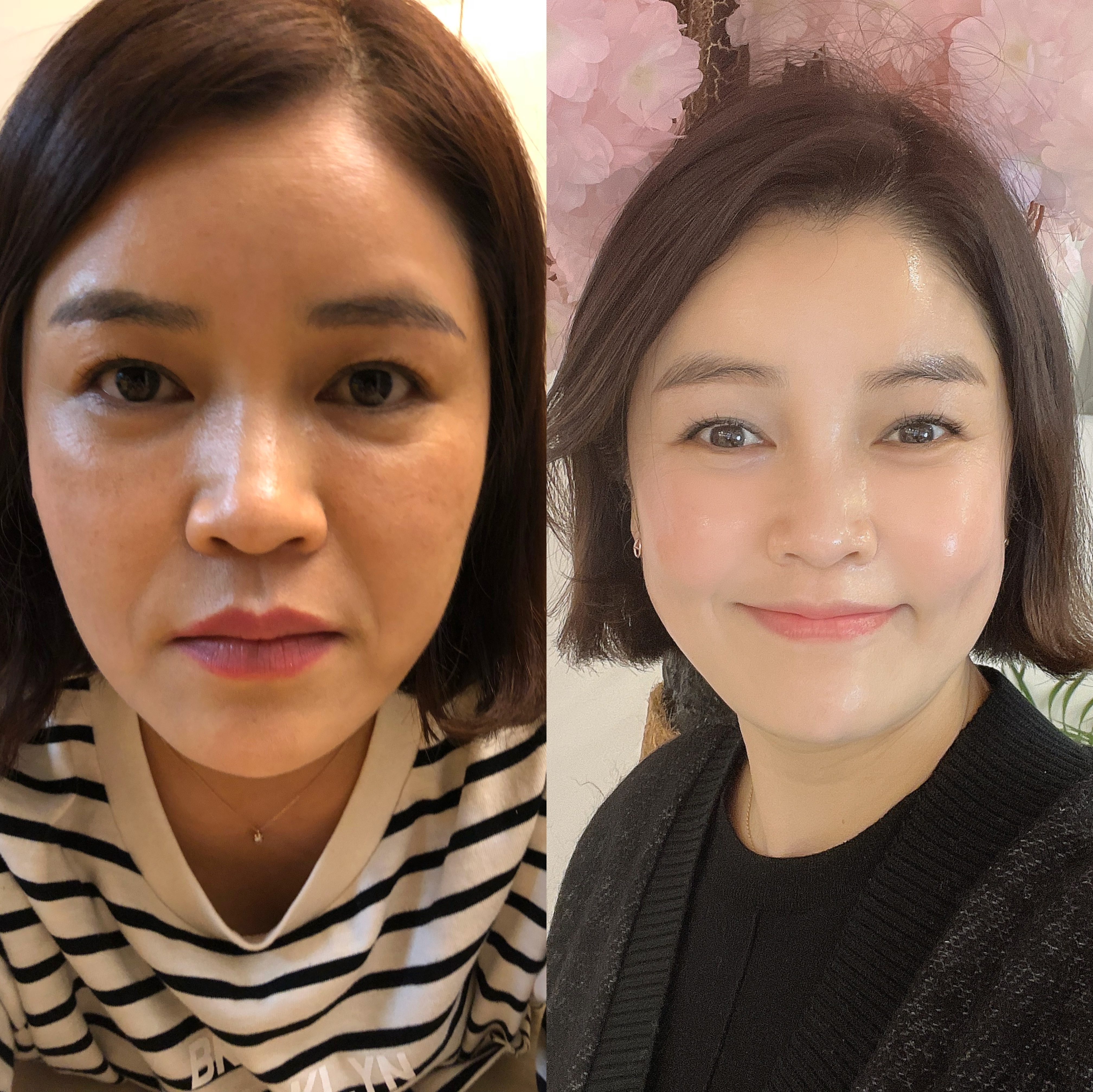 인셀덤 대표 이미지