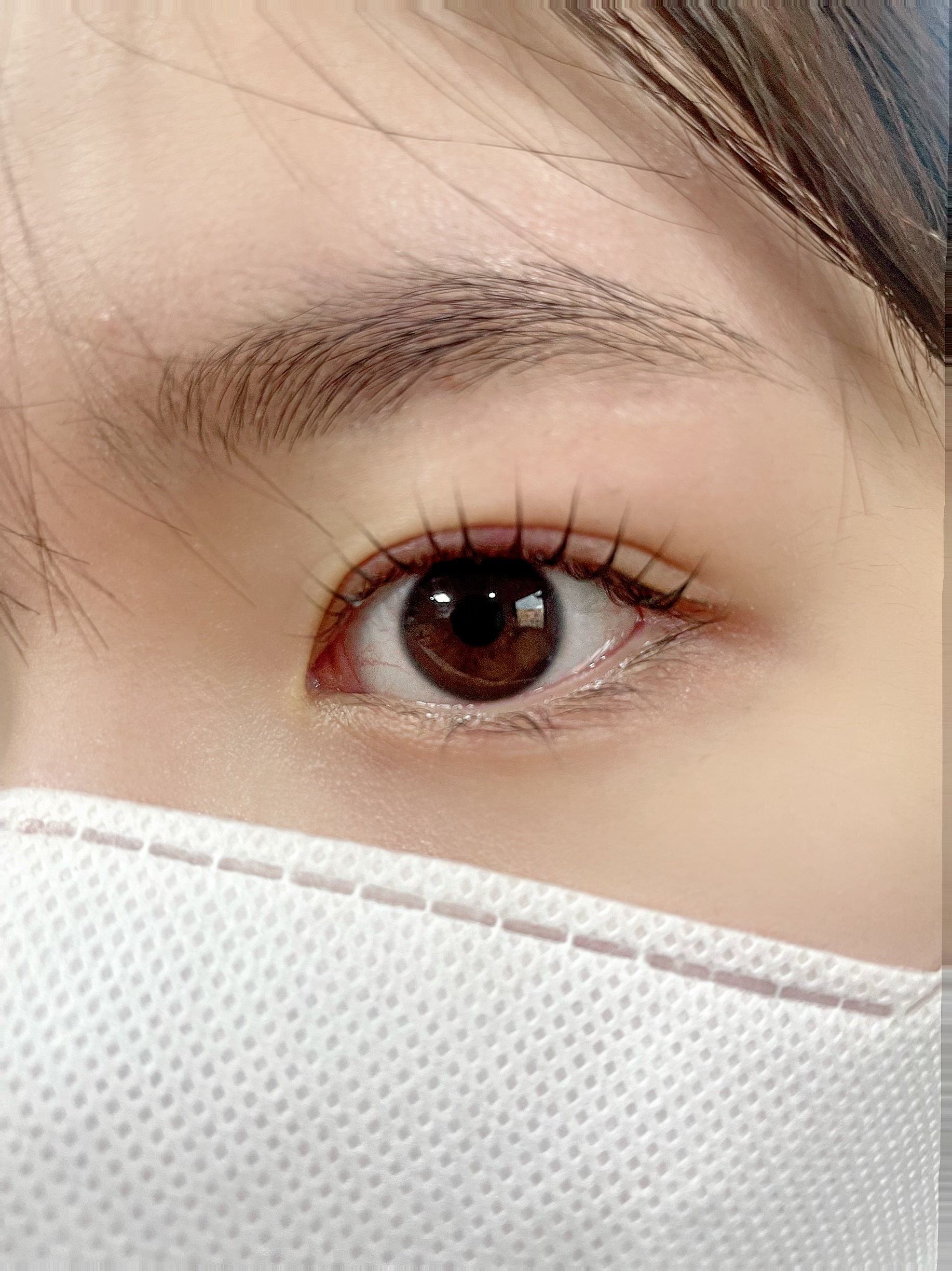 아이꽃피나