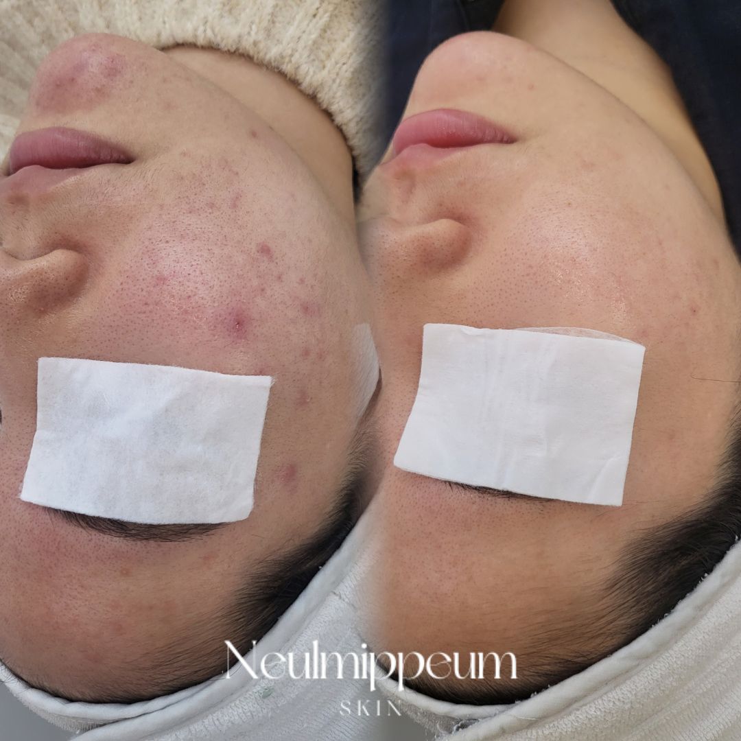 늘미쁨스킨 대표 이미지