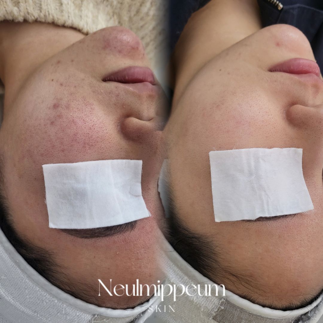 늘미쁨스킨 대표 이미지