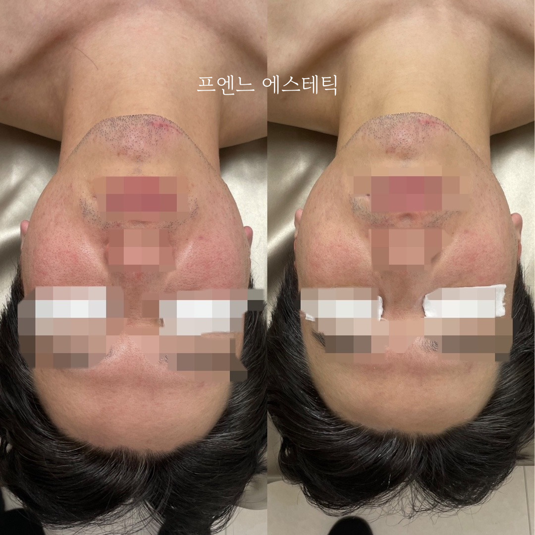 라온제이 에스테틱