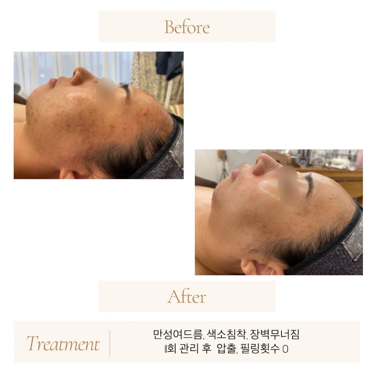 진스홉스킨 대표 이미지