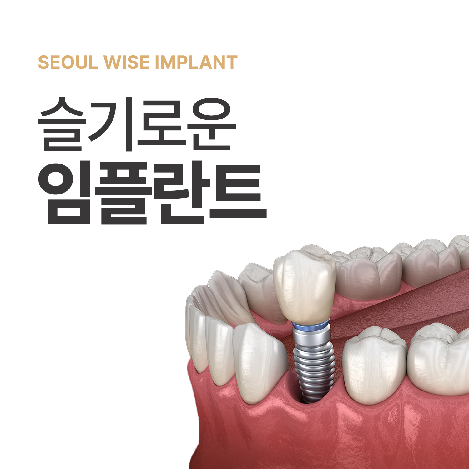 서울슬기로운치과의원 대표 메뉴
