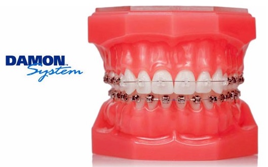 오블리제치과의원 대표 이미지