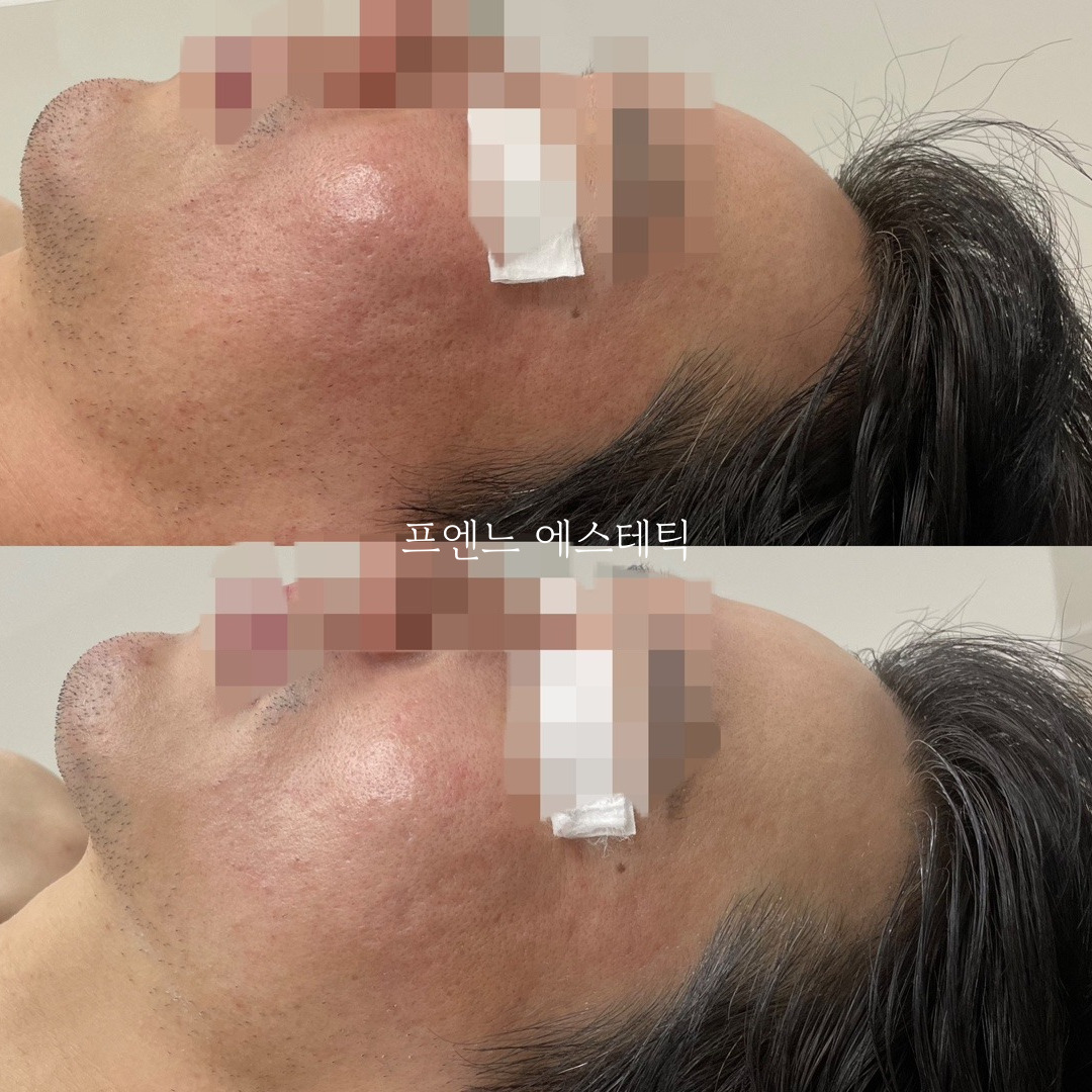 라온제이 에스테틱