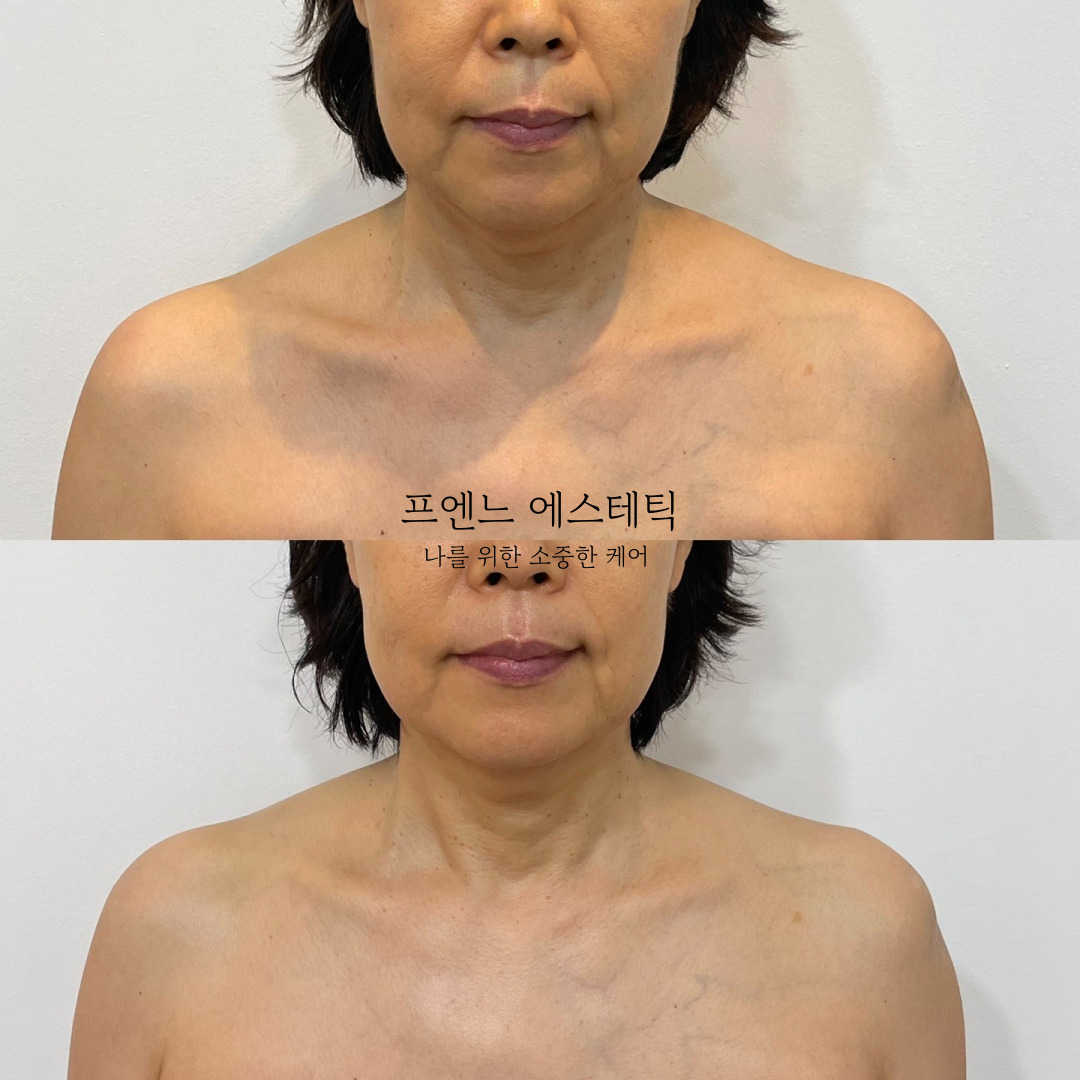 라온제이 에스테틱