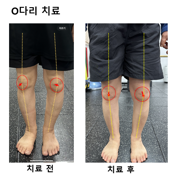 리메이크재활운동센터 대표 이미지