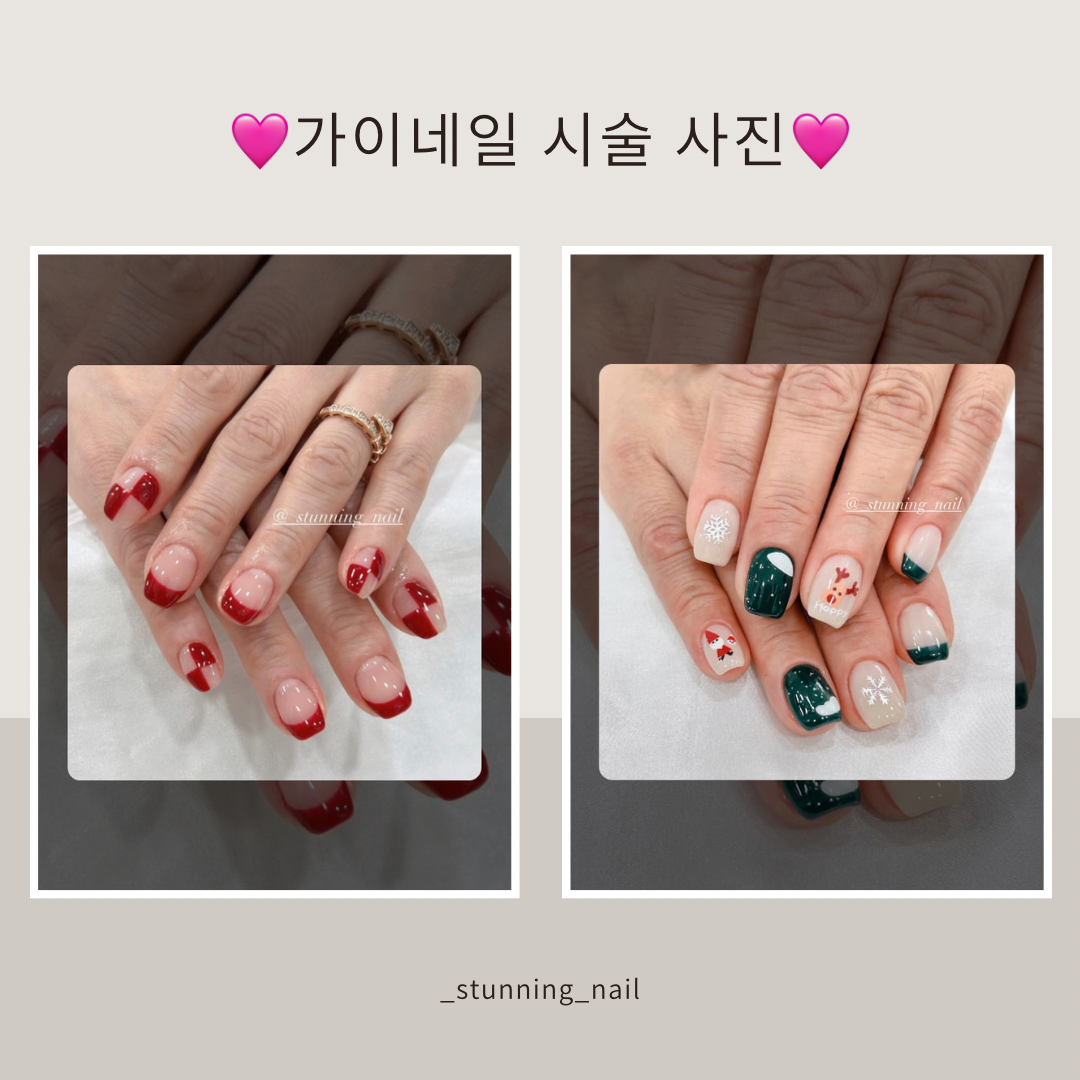 가이네일