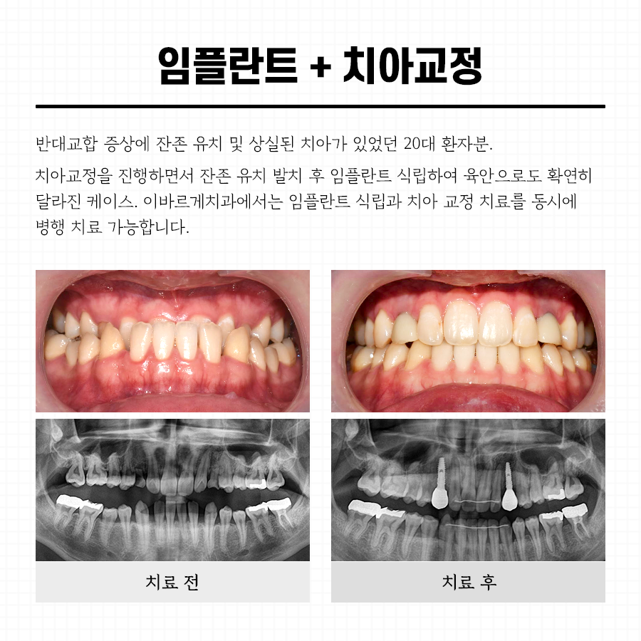 이바르게치과의원 대표 이미지