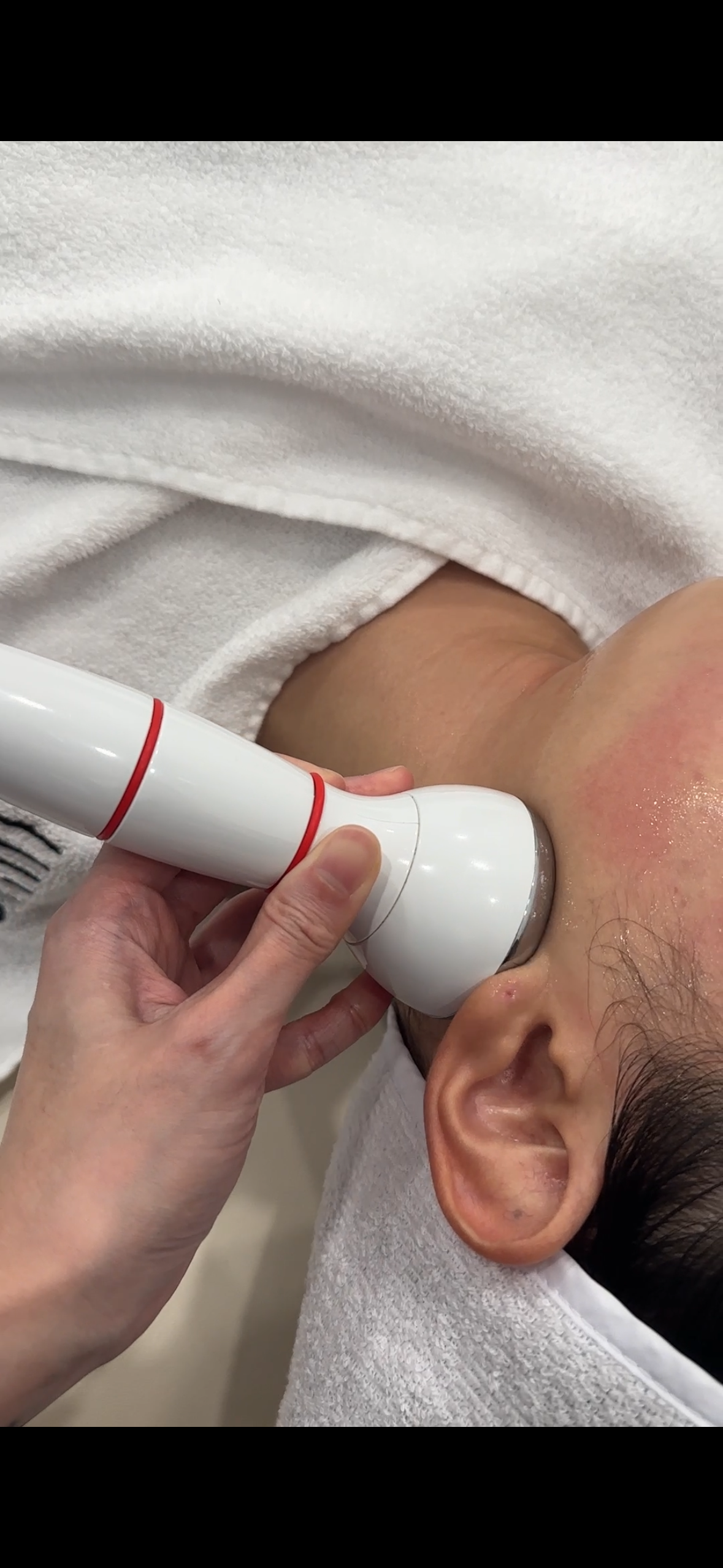 하이필스킨 대표 이미지