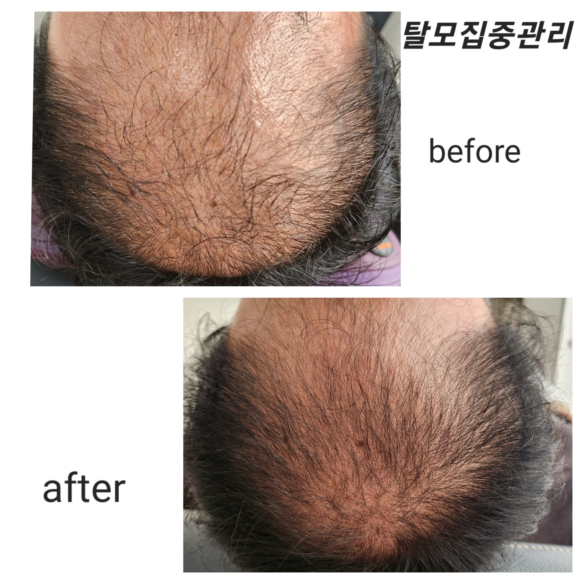 디에이치스킨스칼프
