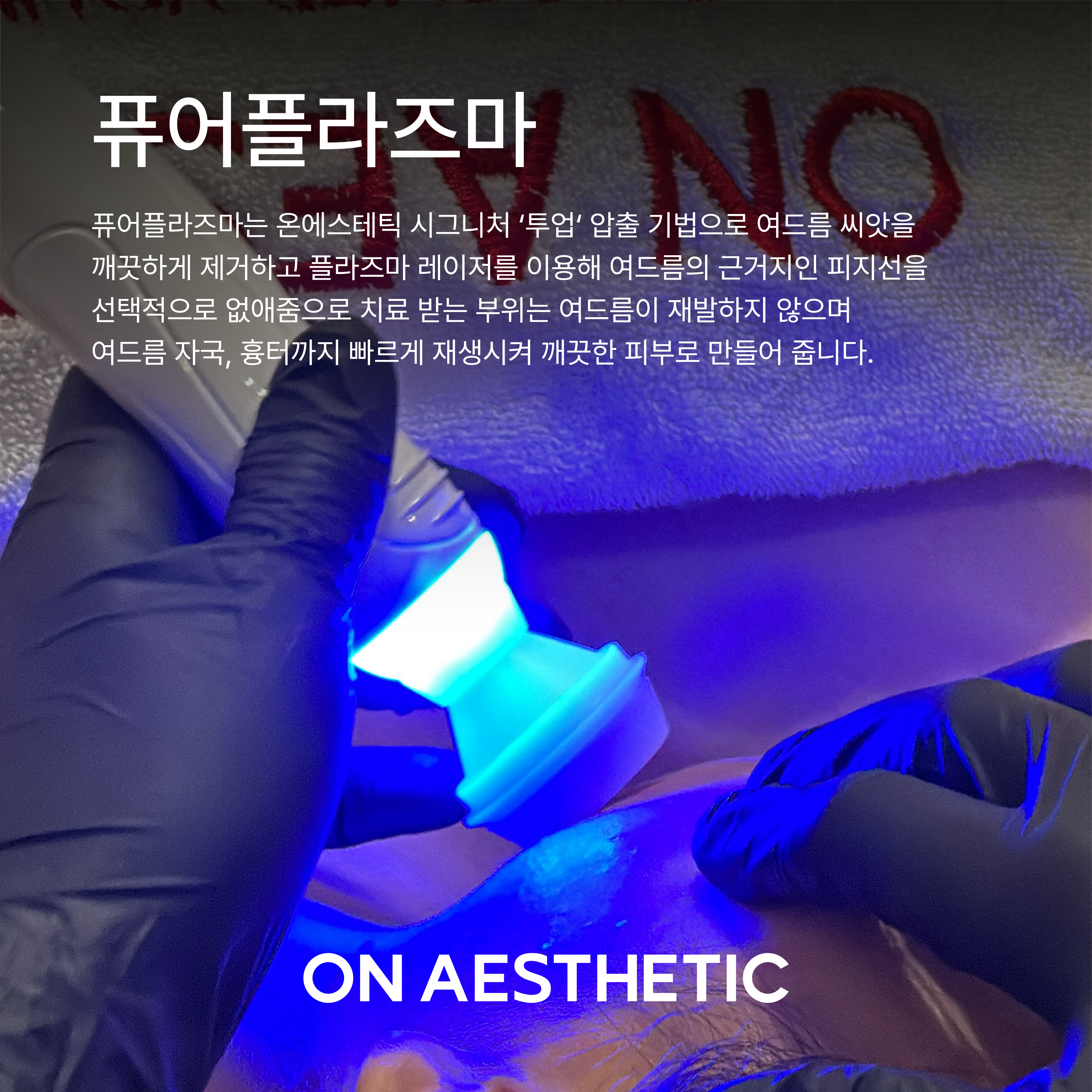 온에스테틱 광주점