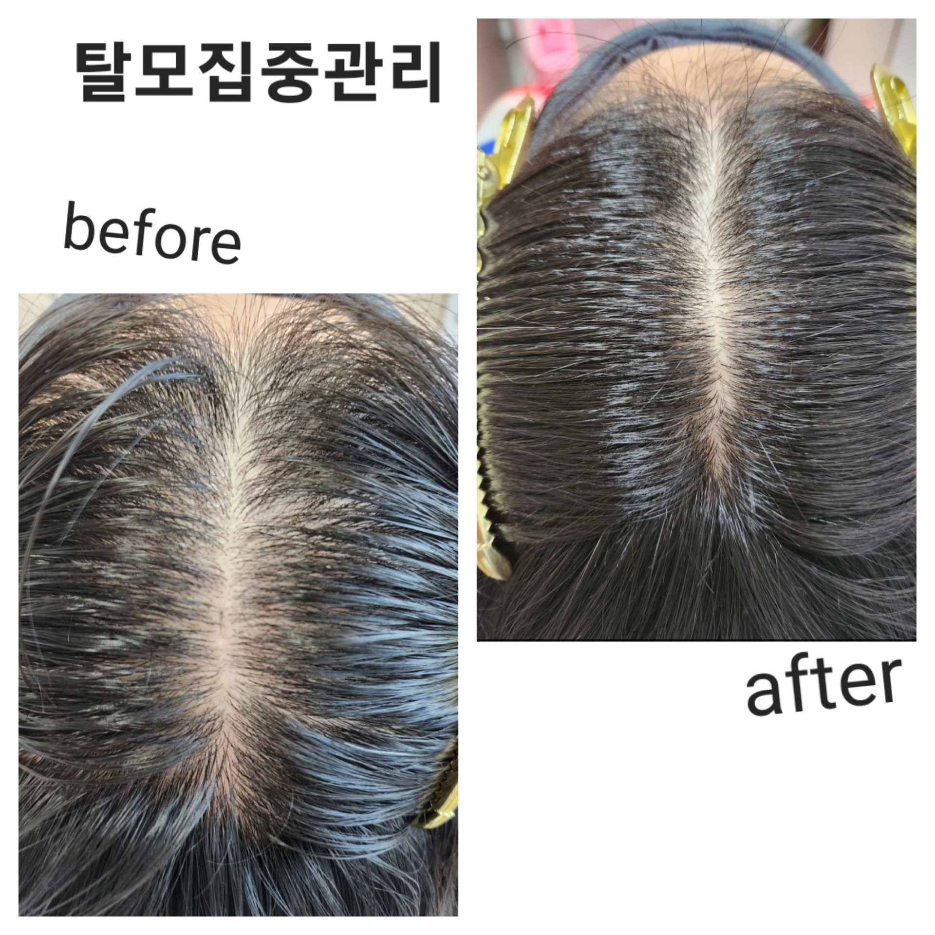 디에이치스킨스칼프