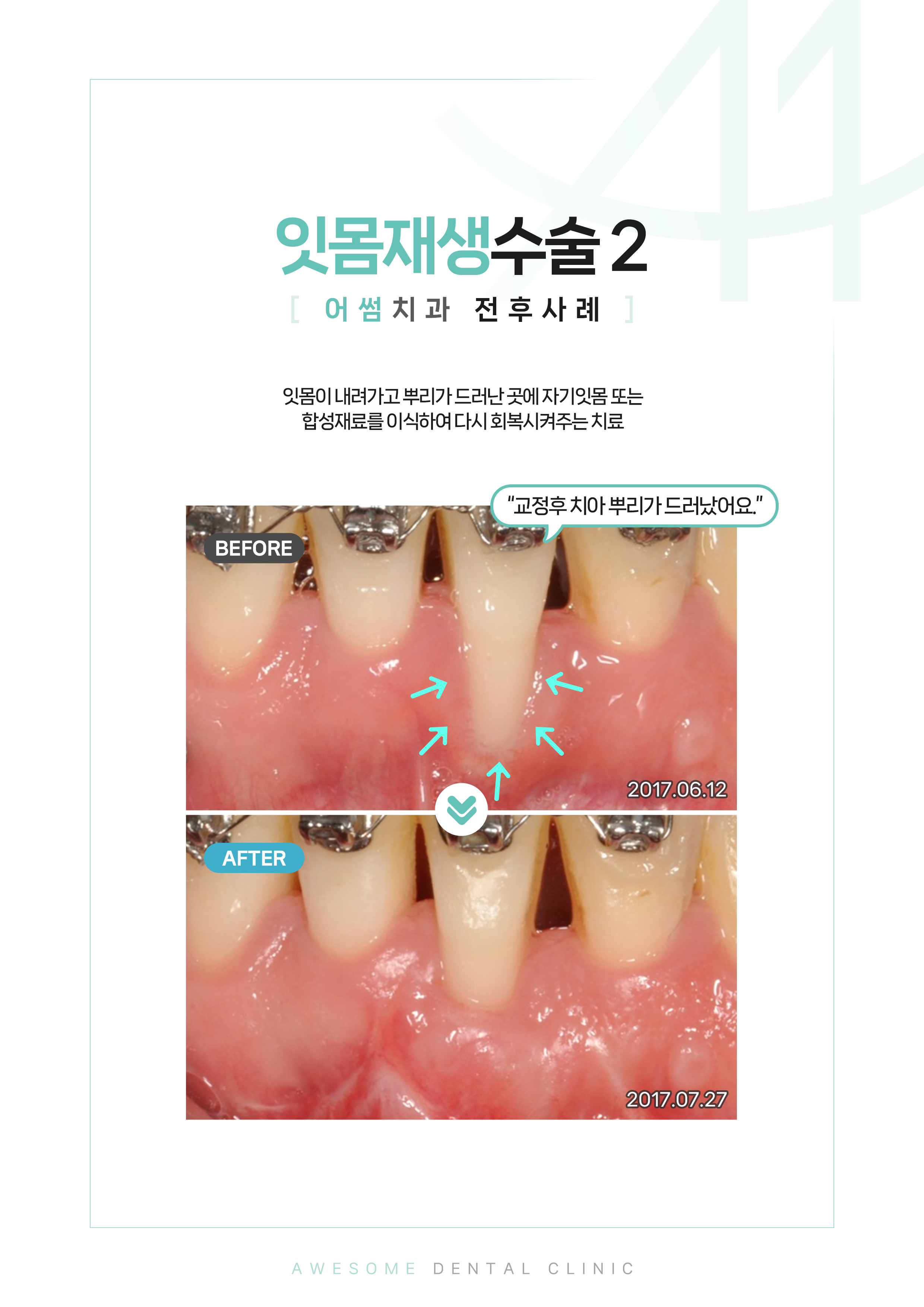 어썸치과의원 대표 이미지