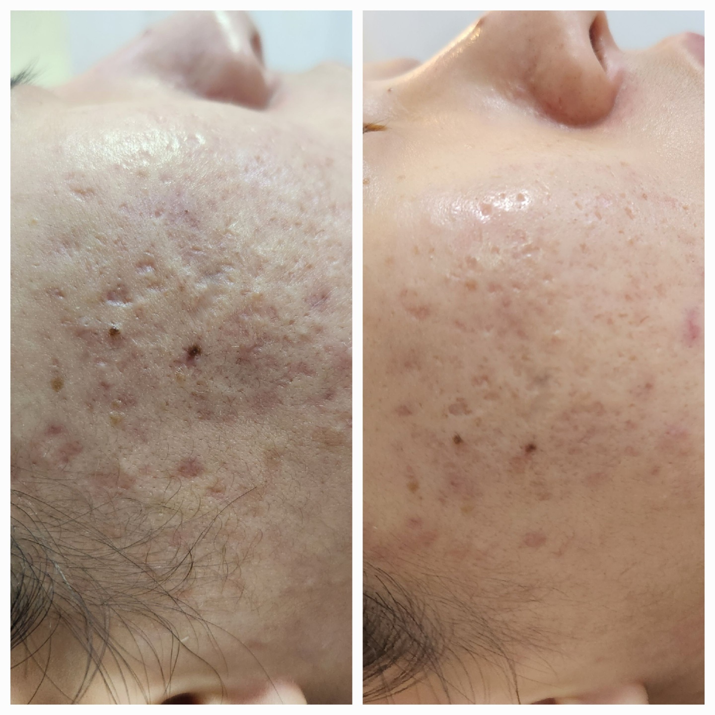 채움피부연구소 동탄본점 대표 이미지