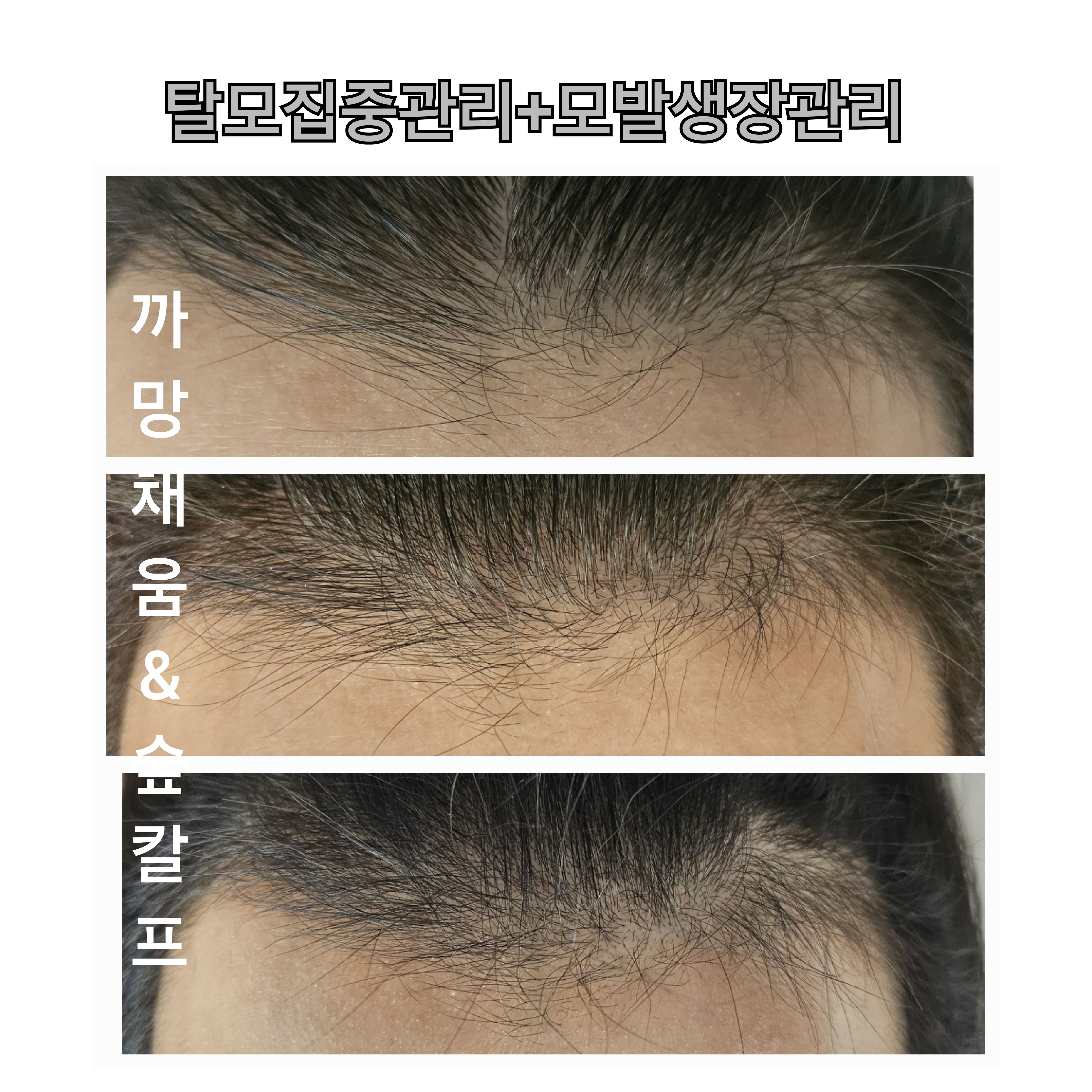 까망채움스칼프