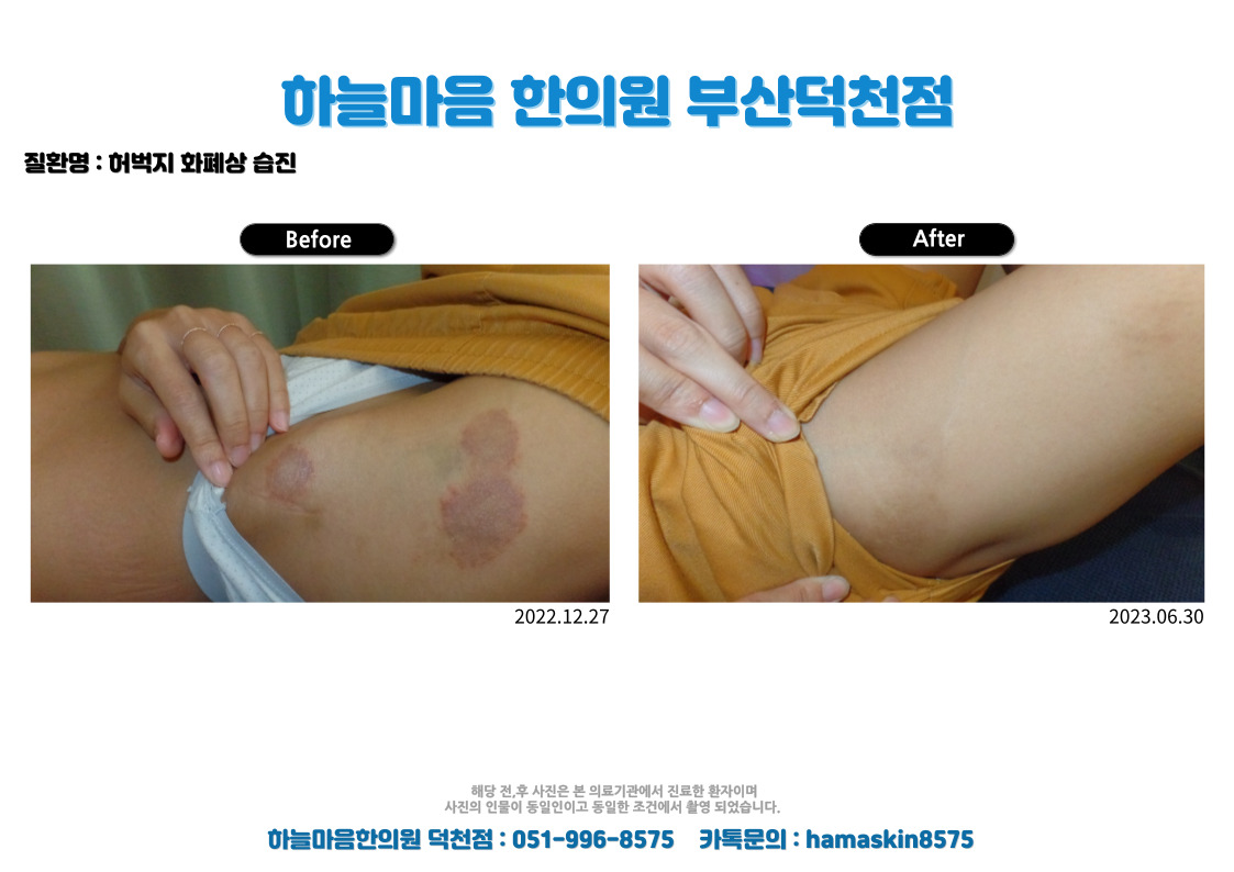 하늘마음한의원 부산덕천