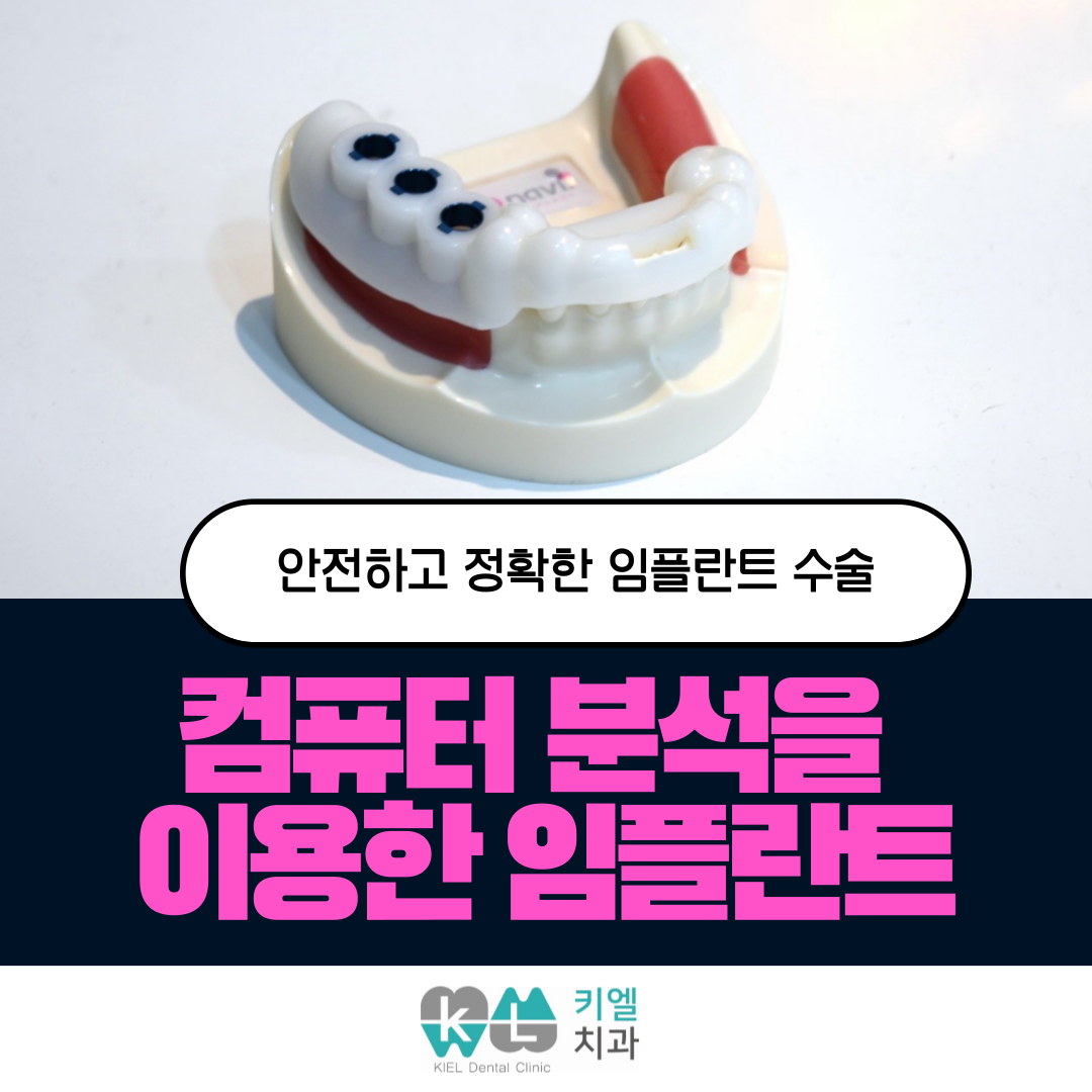 키엘치과 대표 이미지