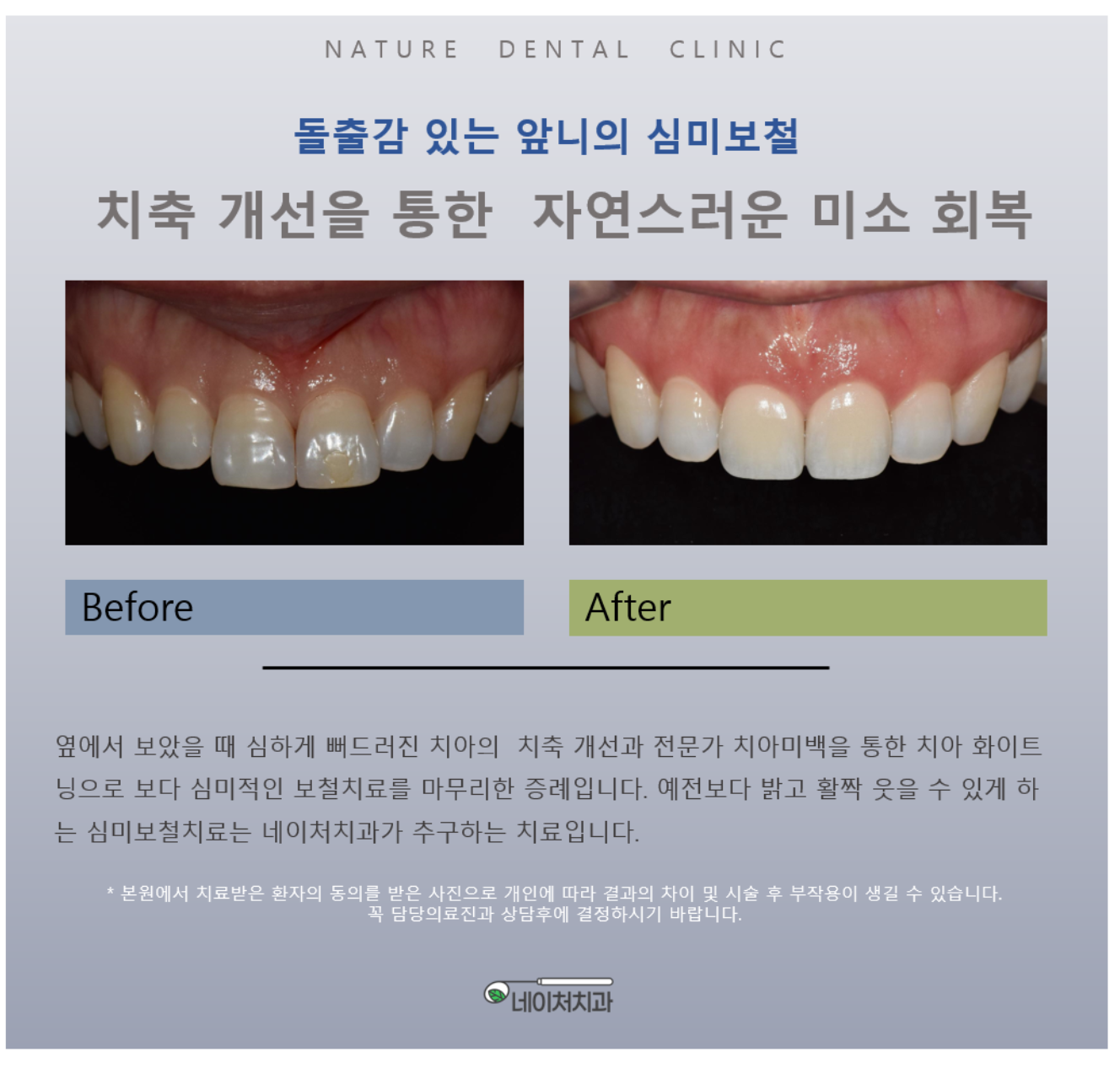 네이처치과의원 대표 이미지