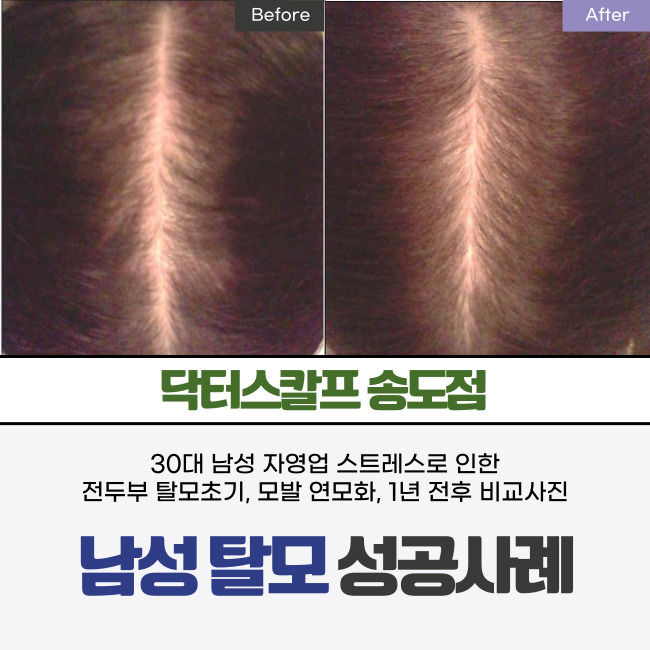 닥터스칼프 인천송도점