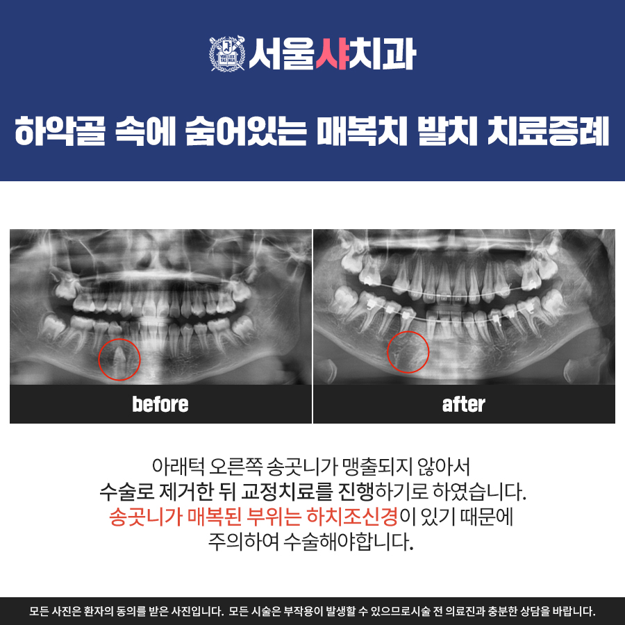 서울샤치과의원 대표 이미지