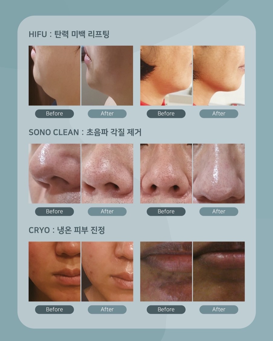 더어려지다에스테틱