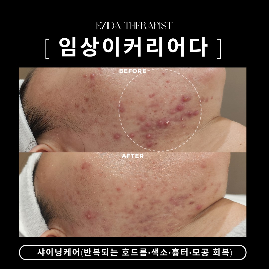 얼리움 에스테틱 이지다