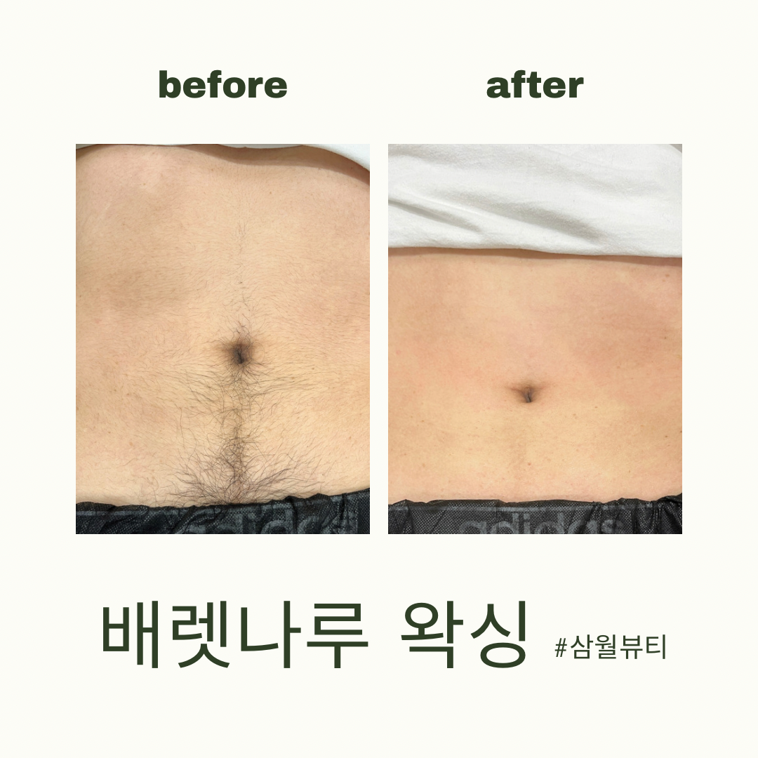 삼월뷰티 왁싱 서면전포점